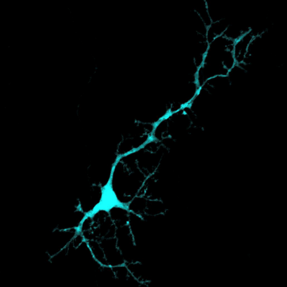 Microscope image of a neuron